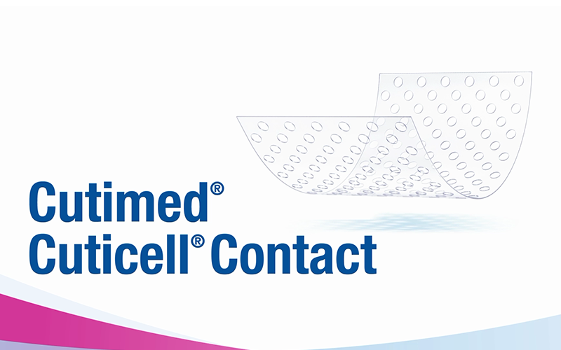 Dieses Video zeigt, wie Cutimed Contact zur Behandlung von akuten und chronischen Wunden angewendet werden kann. Dieses Video zeigt, wie Cutimed Contact zur Behandlung von akuten und chronischen Wunden angewendet werden kann.